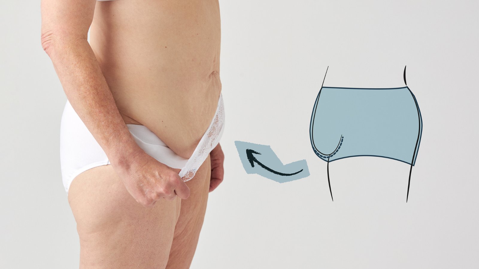 Freedom skin-relief white